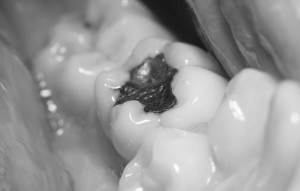 dentiste